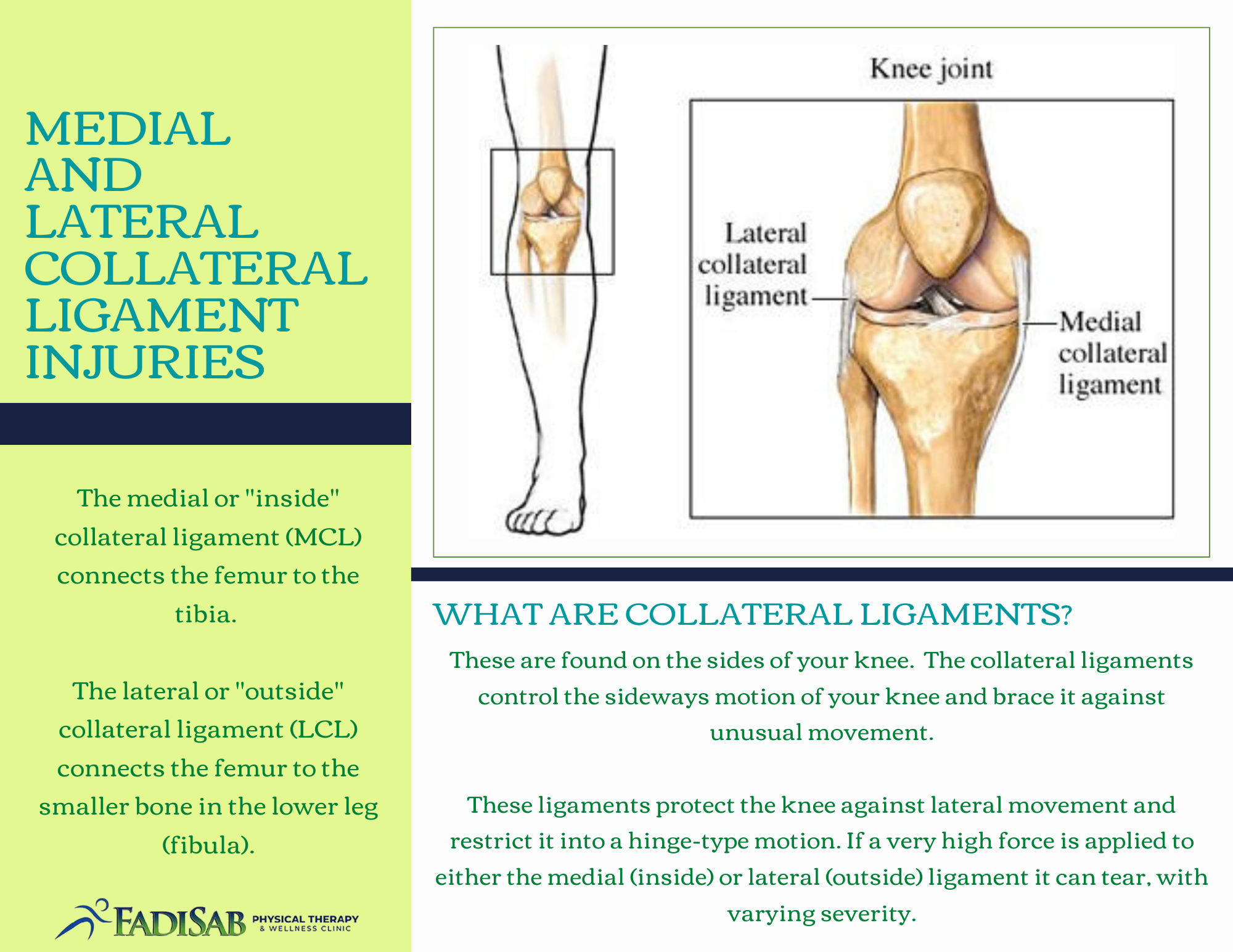 Medial Collateral Ligament (MCL) Tears